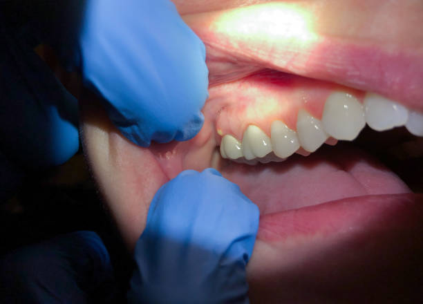 Best Broken or Cracked Tooth Emergency Dentist in Danielson, CT