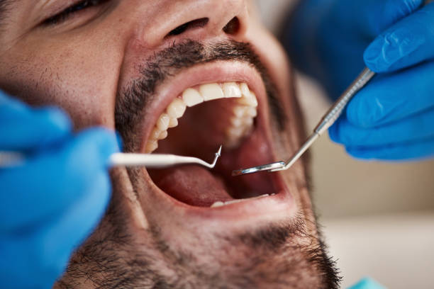 Best Pediatric Emergency Dentist in Danielson, CT